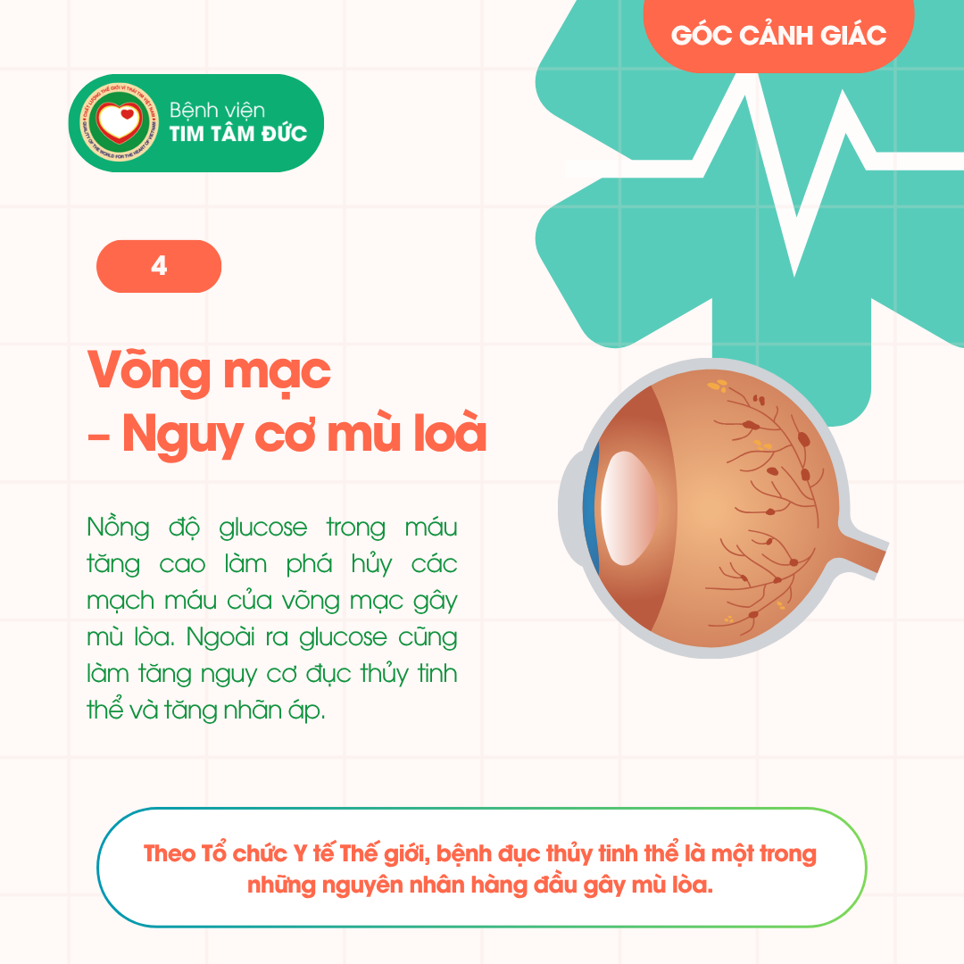 bệnh võng mạc đái tháo đường