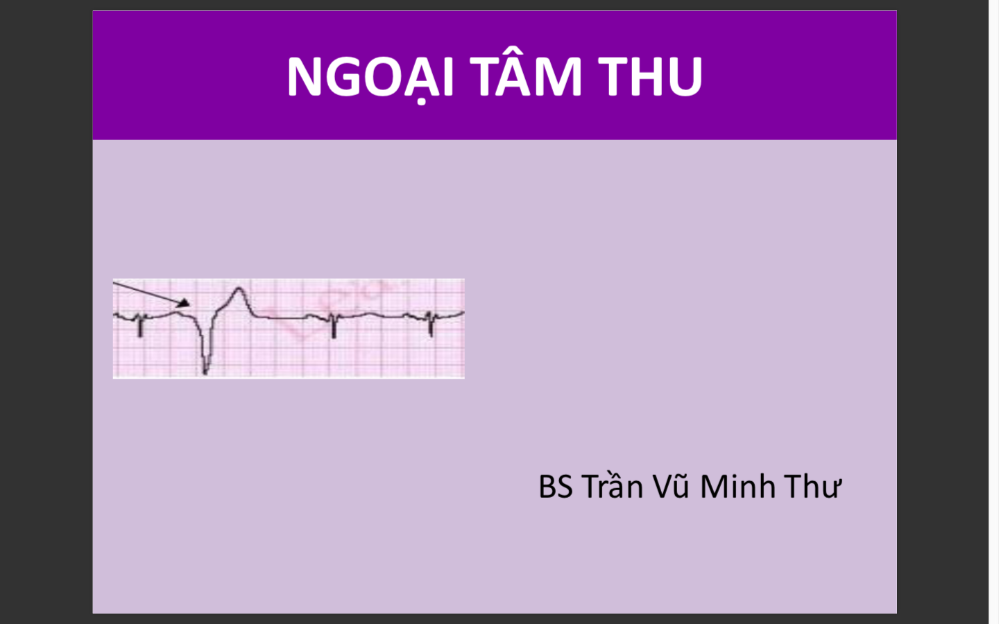 Ngoại tâm thu 2018