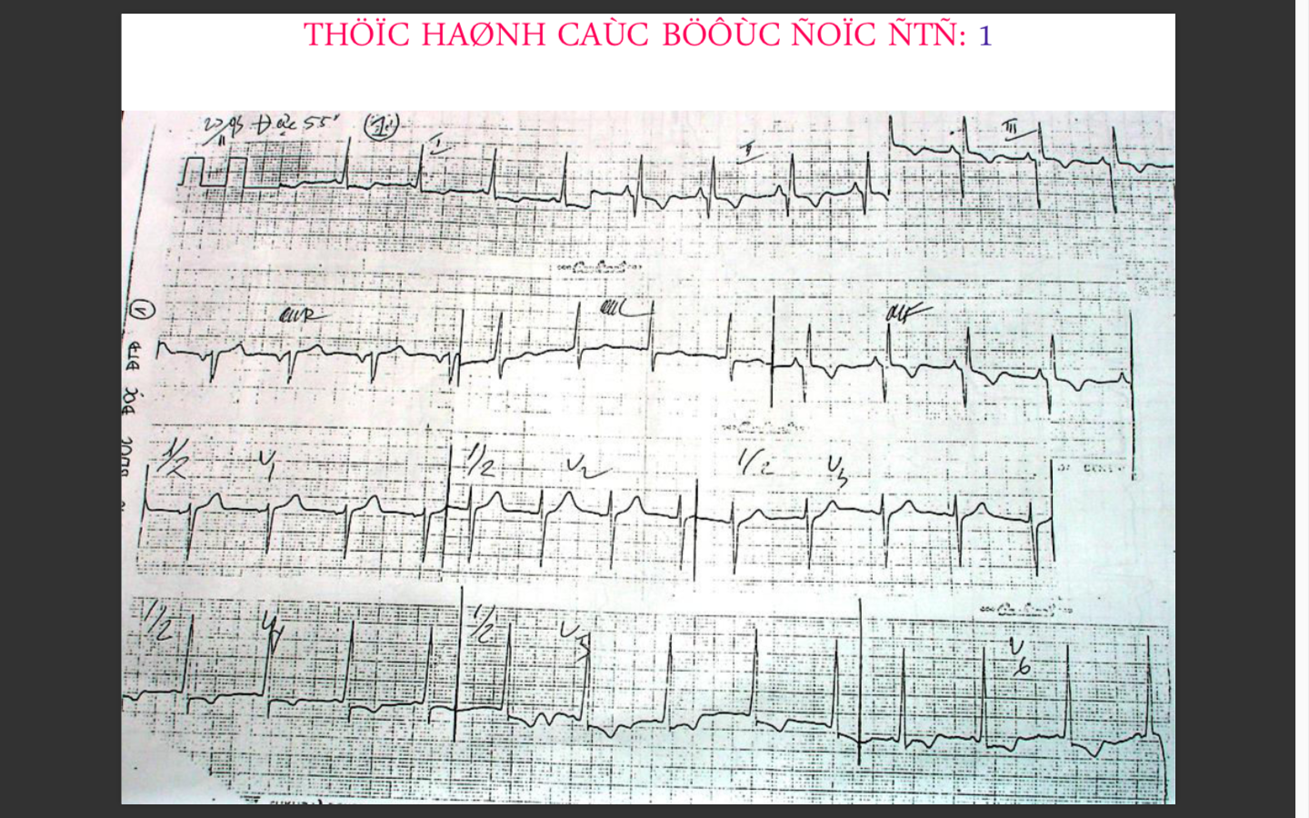 Thực hành các bước đọc DTD
