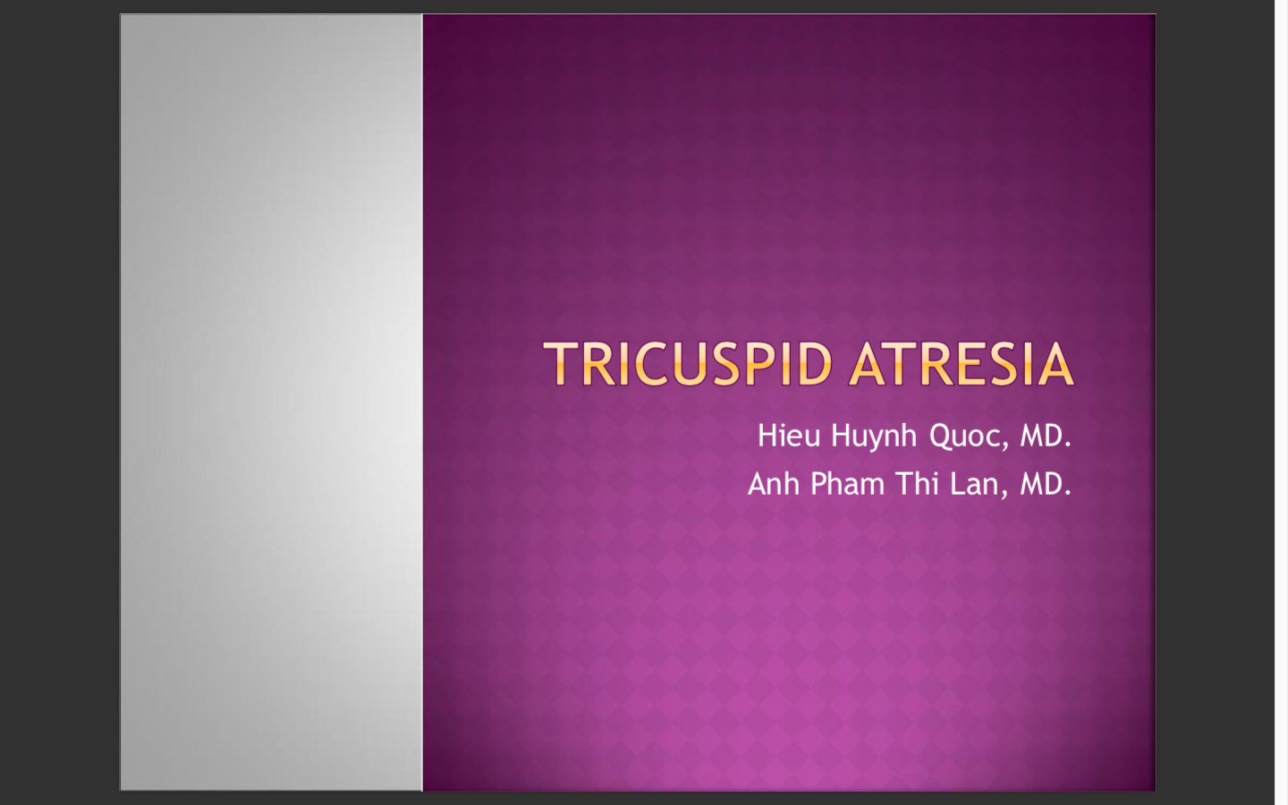 Tricuspid Atresia
