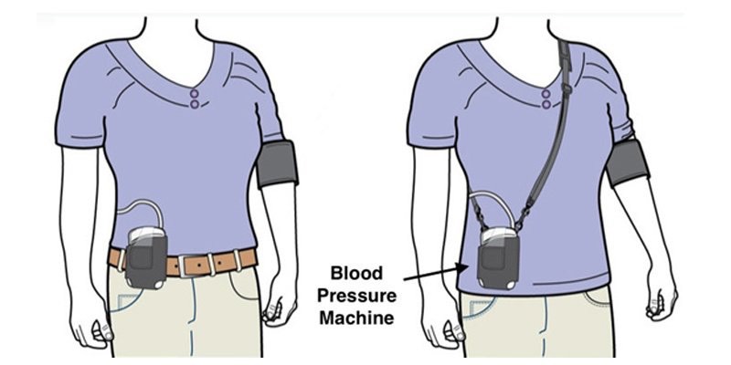 HOLTER Huyết Áp