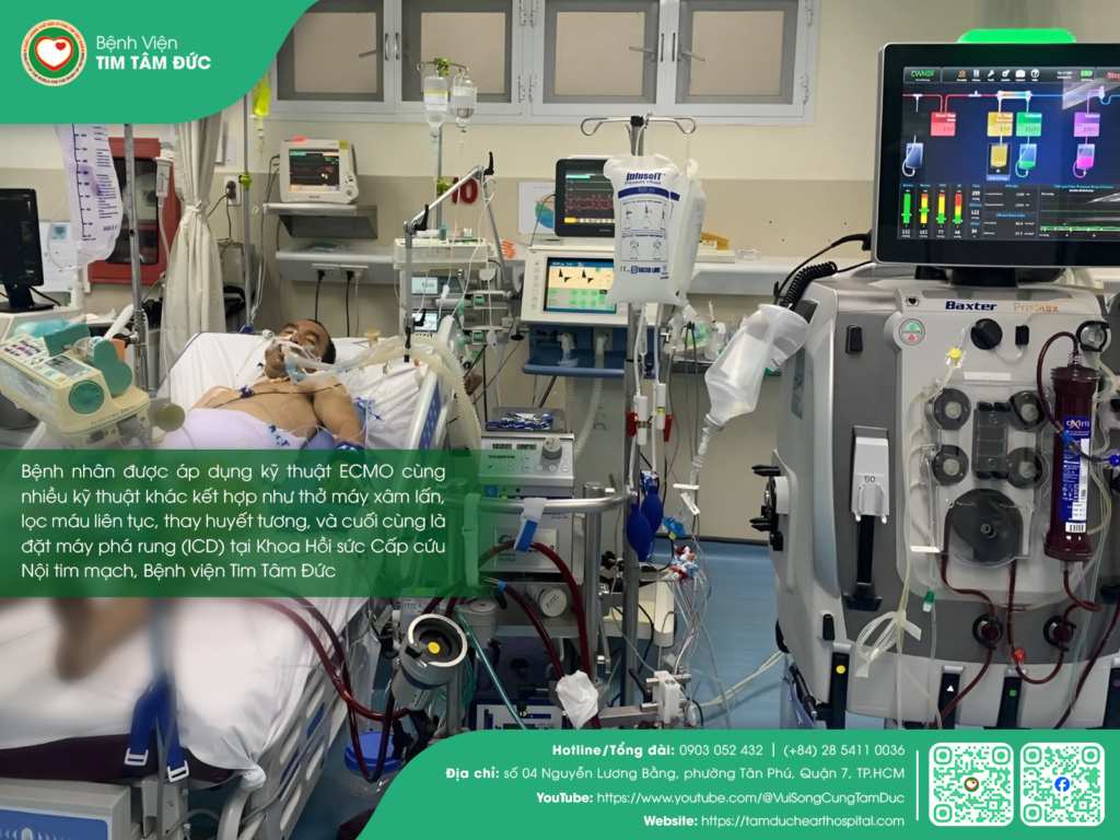 Bệnh nhân được điều trị ECMO