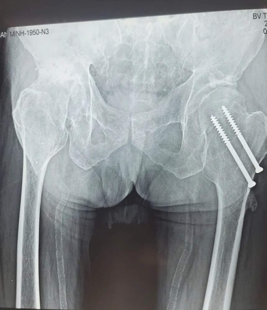 Xray bệnh nhân