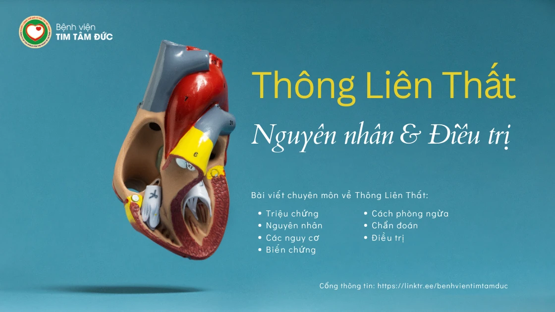 Bệnh tim Thông liên thất là gì? Nguyên nhân và Điều trị