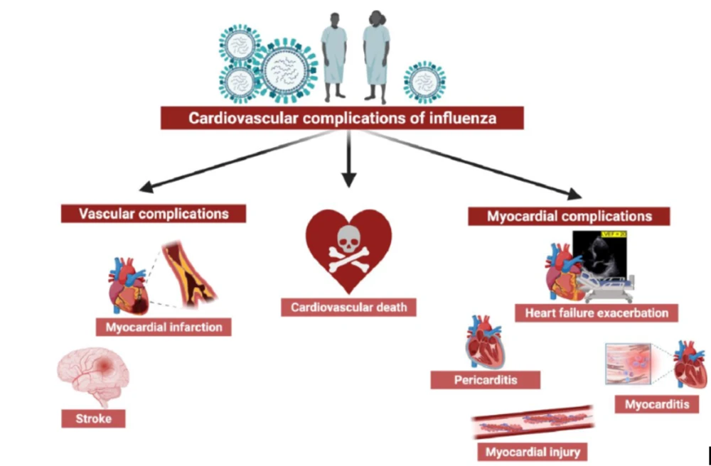 Biến chứng tim mạch của virus cúm - Nguồn: Researchgate.net