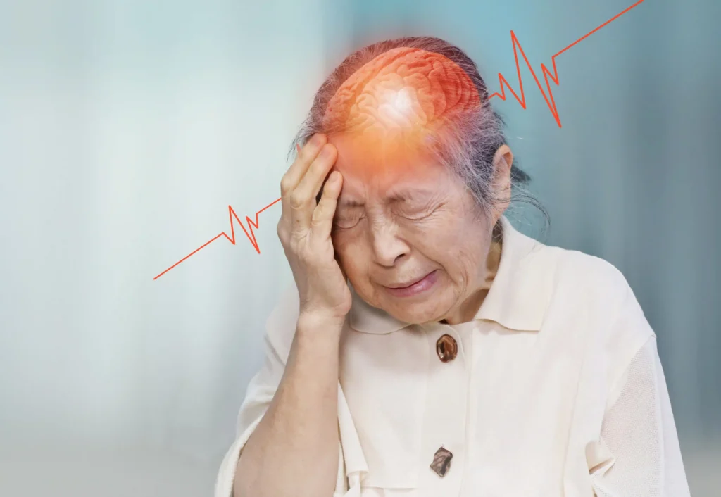 dấu hiệu đột quỵ