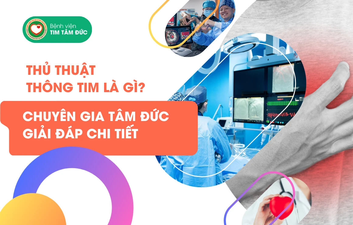 Thủ thuật thông tim: Cẩm nang toàn diện từ Chuyên gia Tâm Đức